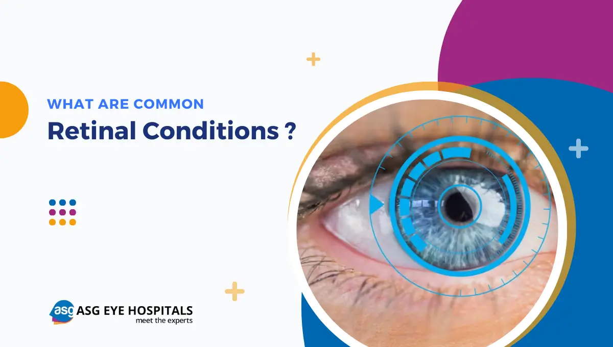 Retinal Disorders