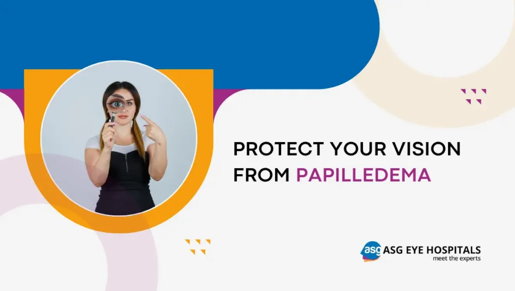 What is papilledema