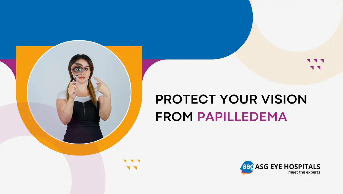 What is papilledema