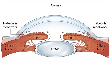 Primary Open-Angle Glaucoma