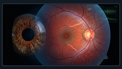 Hypertensive Eye Disease