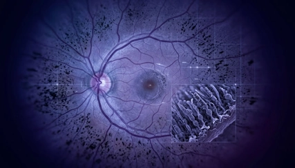 Retinitis Pigmentosa