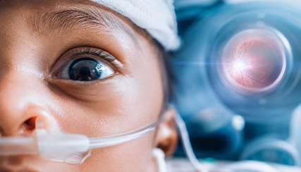Retinopathy of Prematurity