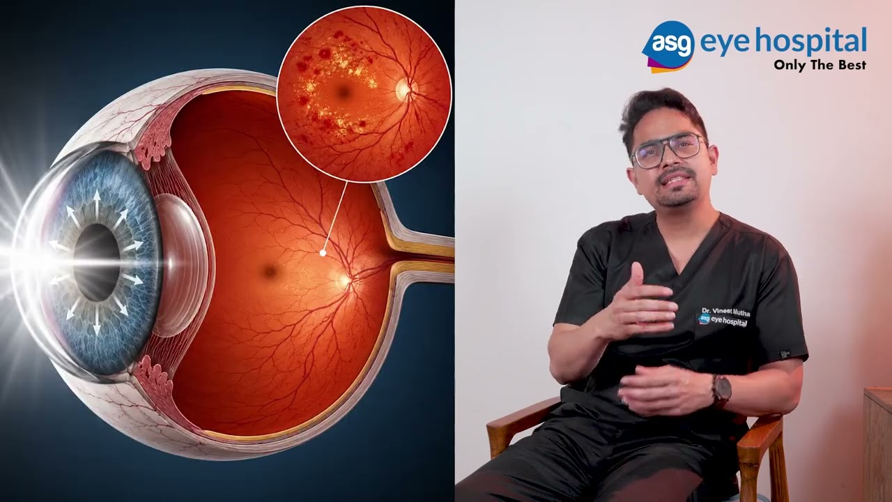 Decoding Diabetic Retinopathy: Recovery & Management | Understanding DR with Dr. Vineet Ep 4